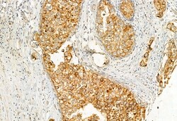 Invitrogen HMGCS1 Polyclonal Antibody 100 &mu;L; Unconjugated:Antibodies,