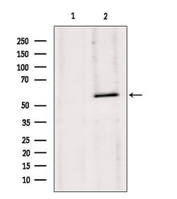 Invitrogen HMGCS1 Polyclonal Antibody 100 &mu;L; Unconjugated:Antibodies,