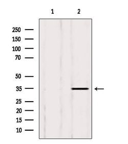 Invitrogen LDHB Polyclonal Antibody 100 &mu;L; Unconjugated:Antibodies,