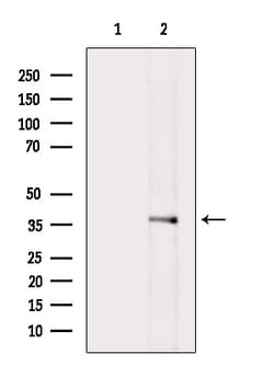 Invitrogen LDHB Polyclonal Antibody 100 &mu;L; Unconjugated:Antibodies,