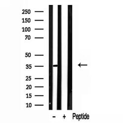 Invitrogen LDHB Polyclonal Antibody 100 &mu;L; Unconjugated:Antibodies,