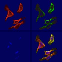 Invitrogen SUCLA2 Polyclonal Antibody 100 &mu;L | Buy Online | Invitrogen&trade; | Fisher Scientific