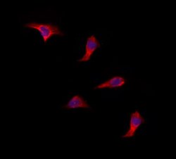 Invitrogen SUCLA2 Polyclonal Antibody 100 &mu;L | Buy Online | Invitrogen&trade; | Fisher Scientific