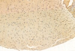 Invitrogen SUCLA2 Polyclonal Antibody 100 &mu;L | Buy Online | Invitrogen&trade; | Fisher Scientific