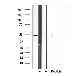 Invitrogen SUCLA2 Polyclonal Antibody 100 &mu;L | Buy Online | Invitrogen&trade; | Fisher Scientific