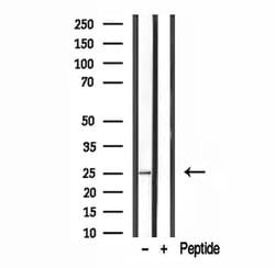 GFER Polyclonal Antibody:Antibodies, Polyclonal