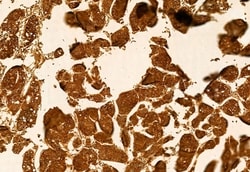 Invitrogen KMO Polyclonal Antibody 100 &mu;L; Unconjugated:Antibodies,