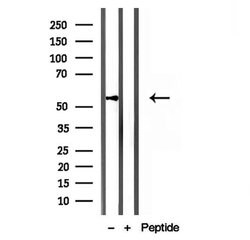 Invitrogen KMO Polyclonal Antibody 100 &mu;L; Unconjugated:Antibodies,