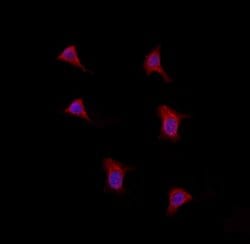 Invitrogen LONP1 Polyclonal Antibody 100 &mu;L; Unconjugated:Antibodies,