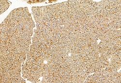 Invitrogen LONP1 Polyclonal Antibody 100 &mu;L; Unconjugated:Antibodies,