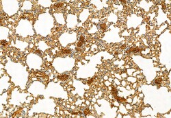 Invitrogen LONP1 Polyclonal Antibody 100 &mu;L; Unconjugated:Antibodies,