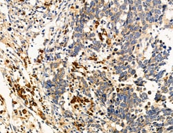 Invitrogen MPV17 Polyclonal Antibody 100 &mu;L; Unconjugated:Antibodies,