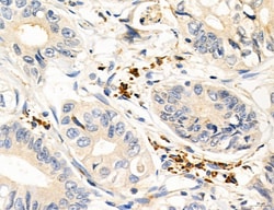 Invitrogen MPV17 Polyclonal Antibody 100 &mu;L; Unconjugated:Antibodies,