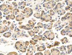 Invitrogen MPV17 Polyclonal Antibody 100 &mu;L; Unconjugated:Antibodies,