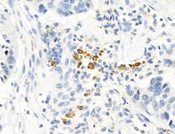 Invitrogen MPV17 Polyclonal Antibody 100 &mu;L; Unconjugated:Antibodies,