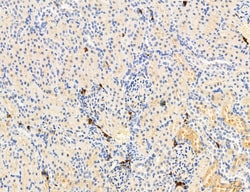 Invitrogen MPV17 Polyclonal Antibody 100 &mu;L; Unconjugated:Antibodies,