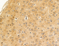 Invitrogen MPV17 Polyclonal Antibody 100 &mu;L; Unconjugated:Antibodies,