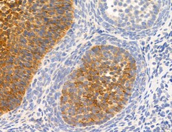 Invitrogen MPV17 Polyclonal Antibody 100 &mu;L; Unconjugated:Antibodies,