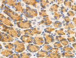Invitrogen MPV17 Polyclonal Antibody 100 &mu;L; Unconjugated:Antibodies,