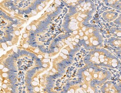 Invitrogen MPV17 Polyclonal Antibody 100 &mu;L; Unconjugated:Antibodies,
