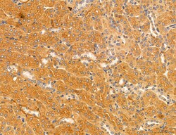 Invitrogen MPV17 Polyclonal Antibody 100 &mu;L; Unconjugated:Antibodies,