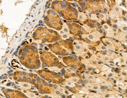 Invitrogen MPV17 Polyclonal Antibody 100 &mu;L; Unconjugated:Antibodies,