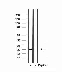 Invitrogen MPV17 Polyclonal Antibody 100 &mu;L; Unconjugated:Antibodies,