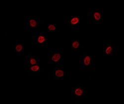 Invitrogen MTA3 Polyclonal Antibody 100 &mu;L | Buy Online | Invitrogen&trade; | Fisher Scientific