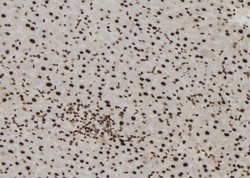 Invitrogen MTA3 Polyclonal Antibody 100 &mu;L | Buy Online | Invitrogen&trade; | Fisher Scientific