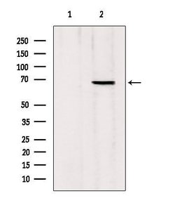 Invitrogen MTA3 Polyclonal Antibody 100 &mu;L | Buy Online | Invitrogen&trade; | Fisher Scientific