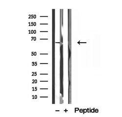 Invitrogen MTA3 Polyclonal Antibody 100 &mu;L | Buy Online | Invitrogen&trade; | Fisher Scientific