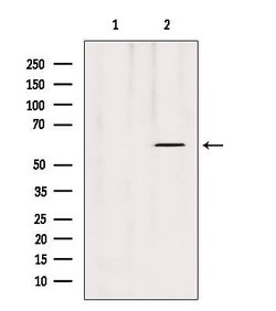 Invitrogen MTA3 Polyclonal Antibody 100 &mu;L | Buy Online | Invitrogen&trade; | Fisher Scientific
