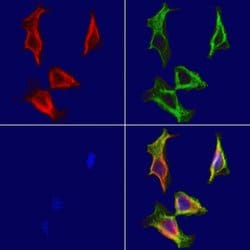Invitrogen MYH7 Polyclonal Antibody 100 &mu;L; Unconjugated:Antibodies,