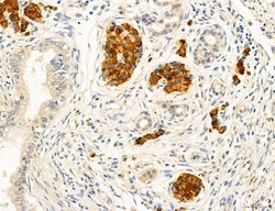 Invitrogen MYH7 Polyclonal Antibody 100 &mu;L; Unconjugated:Antibodies,