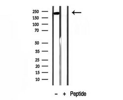 Invitrogen MYH7 Polyclonal Antibody 100 &mu;L; Unconjugated:Antibodies,