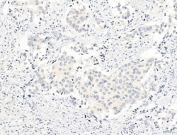 Invitrogen NEU4 Polyclonal Antibody 100 &mu;L; Unconjugated:Antibodies,