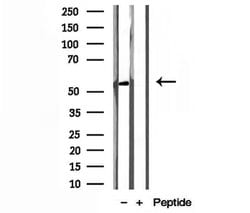 Invitrogen NEU4 Polyclonal Antibody 100 &mu;L; Unconjugated:Antibodies,