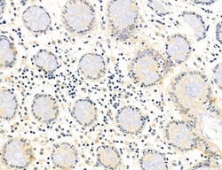 NLRX1 Polyclonal Antibody:Antibodies, Polyclonal