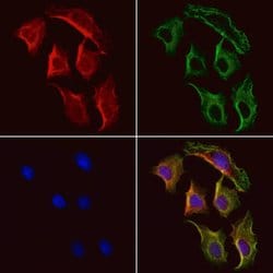 Invitrogen PSAT1 Polyclonal Antibody 100 &mu;L; Unconjugated:Antibodies,