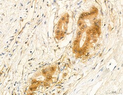 Invitrogen PSAT1 Polyclonal Antibody 100 &mu;L; Unconjugated:Antibodies,