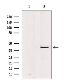 Invitrogen PSAT1 Polyclonal Antibody 100 &mu;L; Unconjugated:Antibodies,