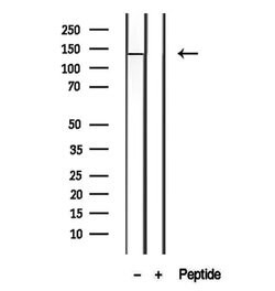 Invitrogen PTPRU Polyclonal Antibody 100 &mu;L; Unconjugated:Antibodies,