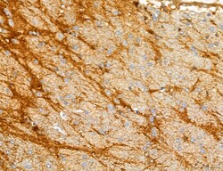 Invitrogen PYGL Polyclonal Antibody 100 &mu;L; Unconjugated:Antibodies,