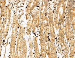 Invitrogen PYGL Polyclonal Antibody 100 &mu;L; Unconjugated:Antibodies,