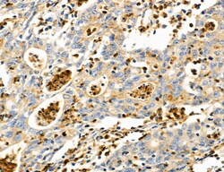 Invitrogen PYGL Polyclonal Antibody 100 &mu;L; Unconjugated:Antibodies,
