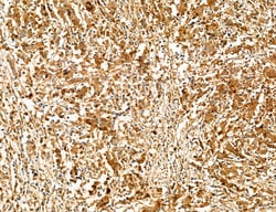 Invitrogen PYGL Polyclonal Antibody 100 &mu;L; Unconjugated:Antibodies,