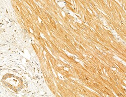 Invitrogen PYGL Polyclonal Antibody 100 &mu;L; Unconjugated:Antibodies,