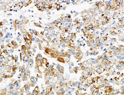 Invitrogen PYGL Polyclonal Antibody 100 &mu;L; Unconjugated:Antibodies,