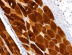 Invitrogen PYGL Polyclonal Antibody 100 &mu;L; Unconjugated:Antibodies,