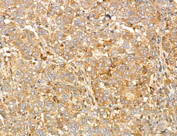 Invitrogen PYGL Polyclonal Antibody 100 &mu;L; Unconjugated:Antibodies,